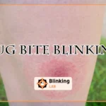 Bug Bite Blinking